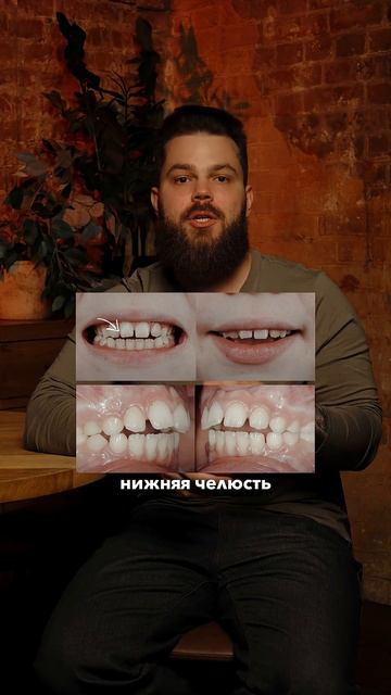 Почему нельзя, чтобы ребёнок дышал ртом? смотреть онлайн