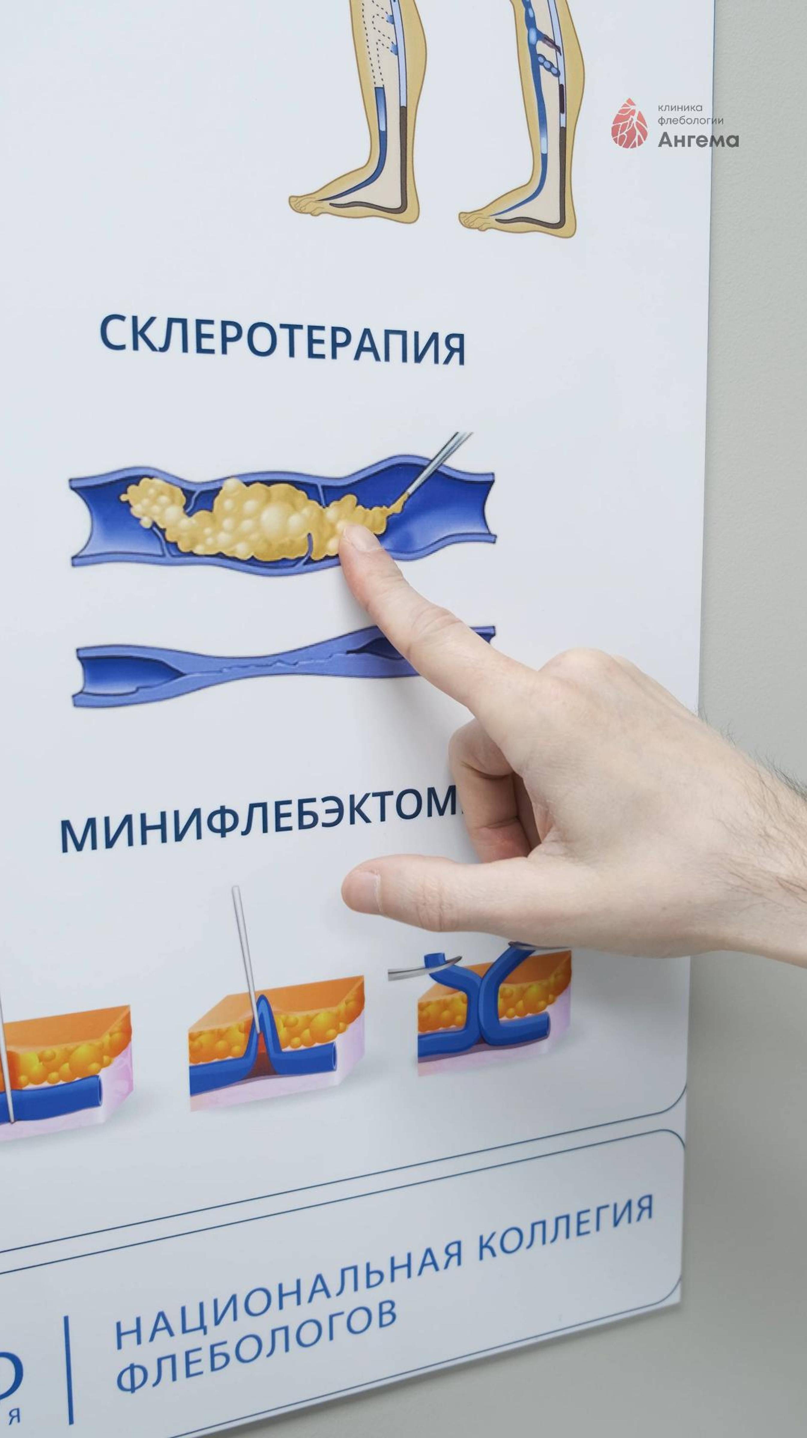 Клиника Ангема