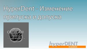 HyperDent - Изменение припуска и допуска