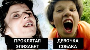 "Проклятая Аннелиза", "девочка-собака", "гигантские братья" – истории которые вас шокируют