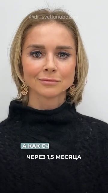 Эндоскопическое омоложение лица. Пластический хирург Светлана Божор #пластическийхирургспб
