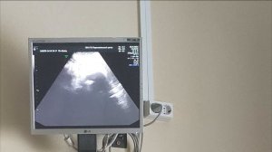 Мальчик или девочка ? Подготовка к родам. Маловодие. Диабет. Из Германии в Россию