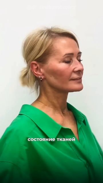 Омоложение нижней трети лица и шеи. Пластический хирург Светлана Божор #омоложение