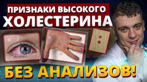 ВЫСОКИЙ ХОЛЕСТЕРИН! 5 ТРЕВОЖНЫХ признаков, ОПРЕДЕЛИТЕ  ДОМА даже БЕЗ ВРАЧЕЙ!