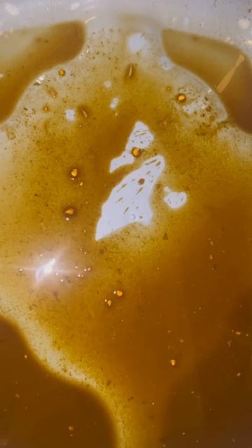 Как вывести камни из желчного смотреть онлайн