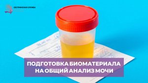 Подготовка биоматериала на общий анализ мочи