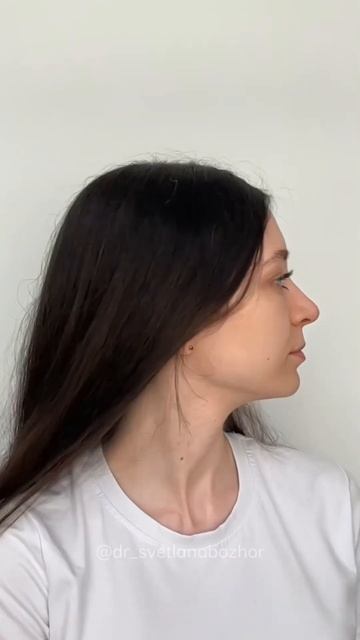 Риносептопластика. Пластический хирург Светлана Божор #риносептопластика