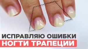 ГНОЙ или ГРИБОК? | Исправляем ногти трапеции