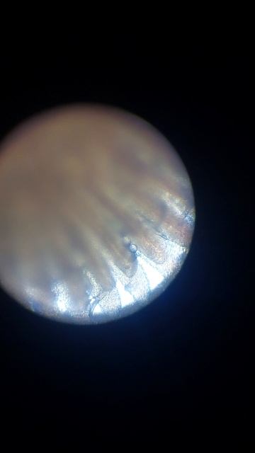 Жаберные сосальщики смотреть онлайн