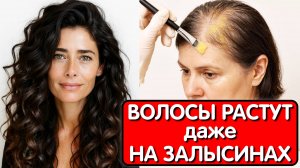 Этот ОТВАР СПАС ОТ ВЫПАДЕНИЯ ВОЛОС и СЕДИНЫ ! Нанесла на корни и волосы растут как сумасшедшие