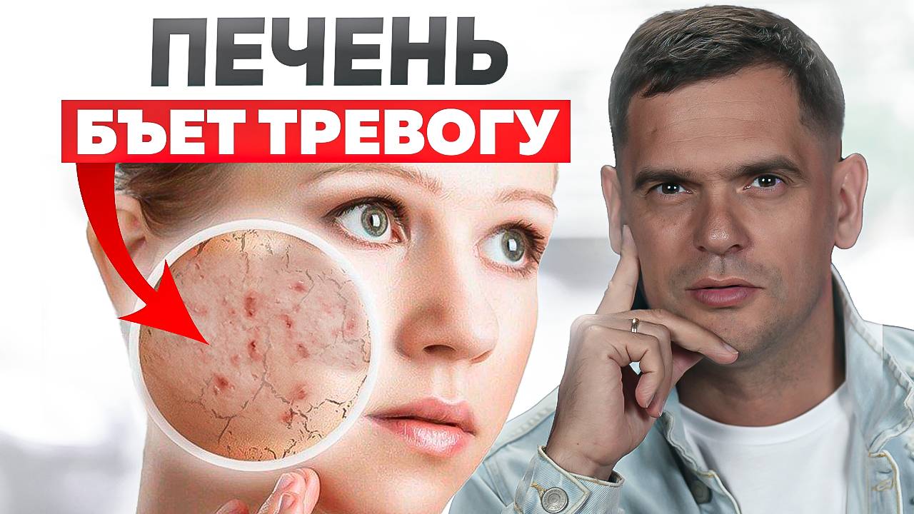5 признаков проблем с печенью которые НЕЛЬЗЯ игнорировать! / Психосоматика гепатита, цирроза печени смотреть онлайн