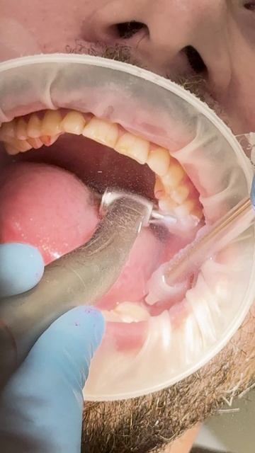 Артем на приемеу стоматолога смотреть онлайн