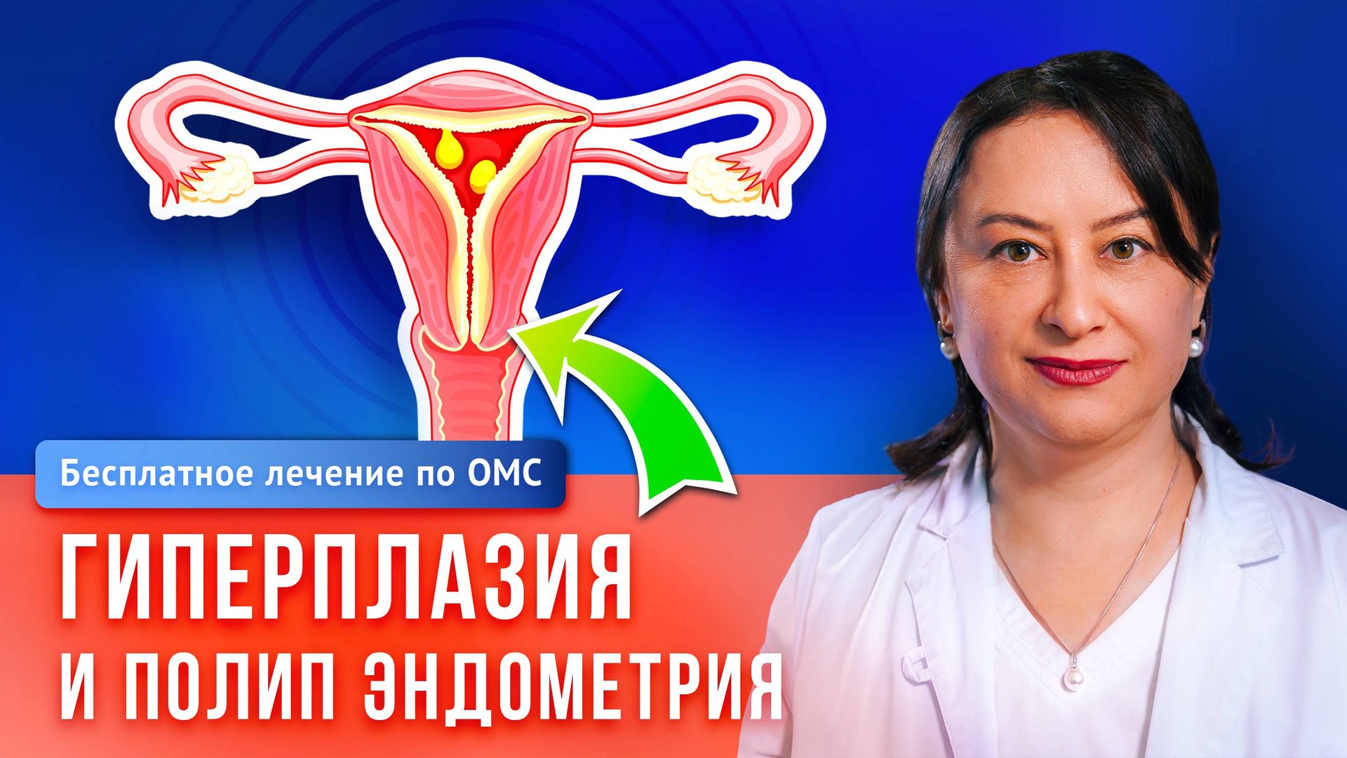 ⚠️ Первые тревожные признаки патологий матки — причины и лечение полипов и гиперплазии эндометрия смотреть онлайн