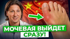 Как избавиться от боли при подагре? Вы удивитесь, но подагра боится обычной…