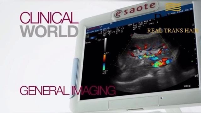 УЗИ смотреть онлайн