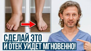 Твое тело КРИЧИТ о помощи! / Рассказываю, как избавиться от отеков раз и НАВСЕГДА!