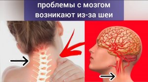 Жизнь сосудов шеи и мозга зависят от зажатых ременных и грудино-сосцевидных мышц шеи. Упражнения