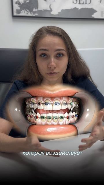 Зачем лечить все зубы перед установкой брекетов