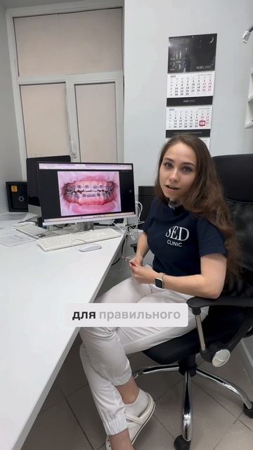 Промежуточный этап лечения брекетами