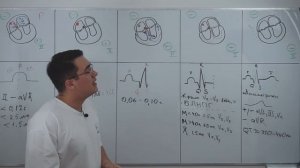 ЭКГ. Базовые знания