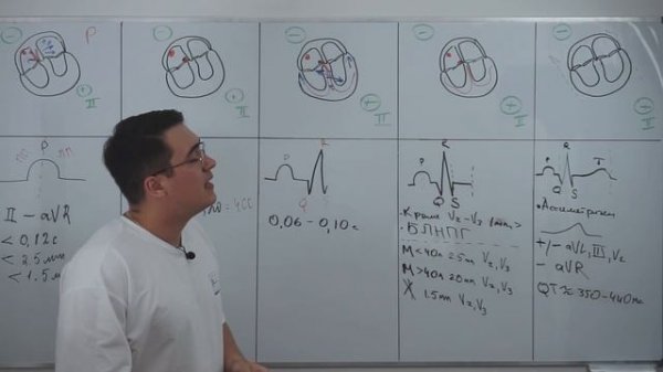 ЭКГ. Базовые знания