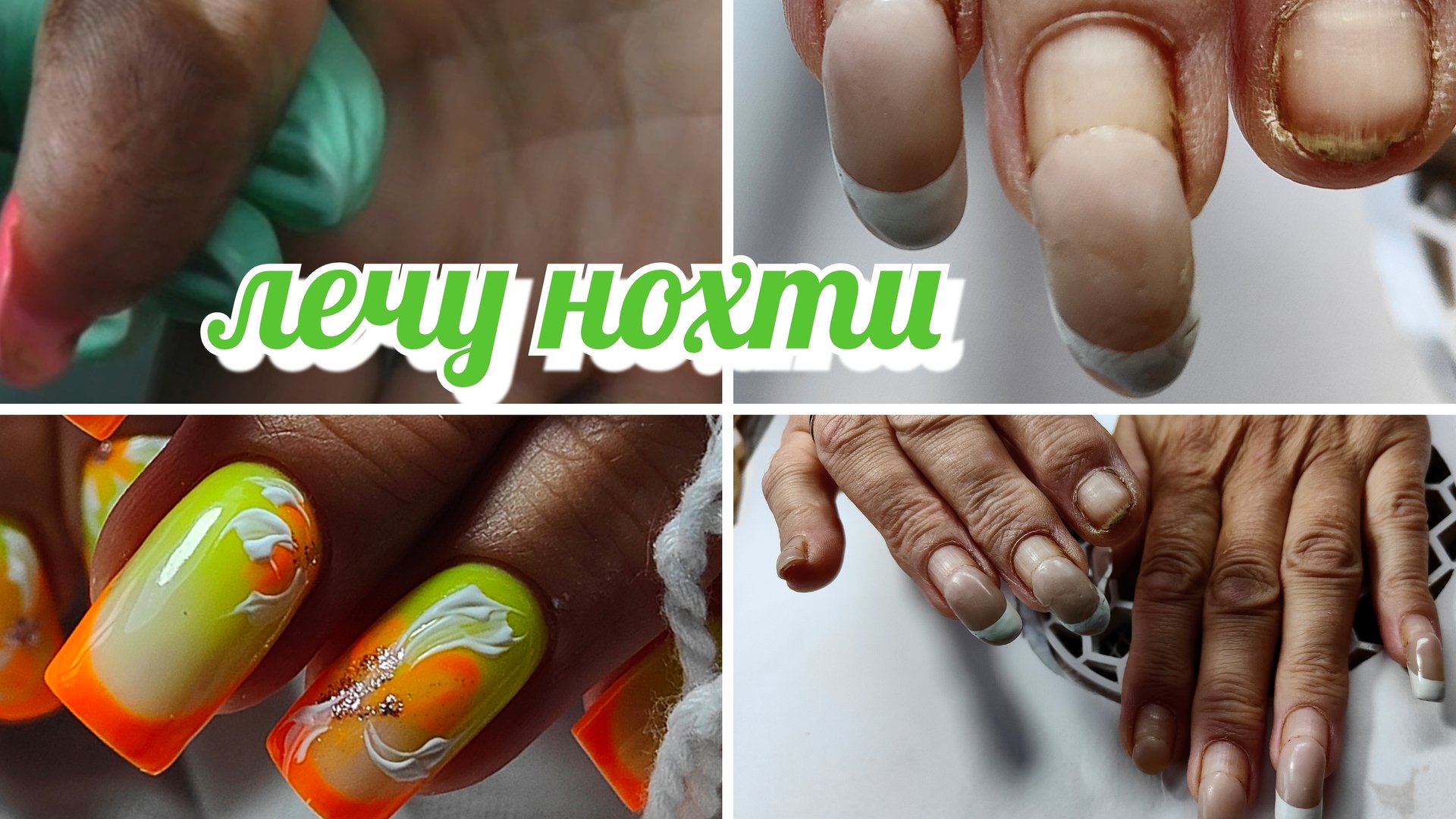 Новая клиентка 👀 с грибками 💩 Простой и быстрый дизайн смотреть онлайн