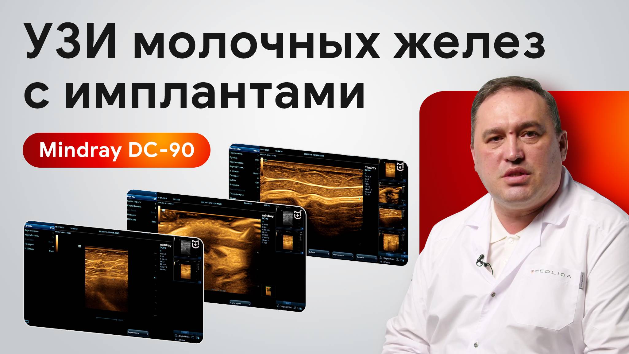 Мастер-класс по УЗИ молочных желез с имплантами