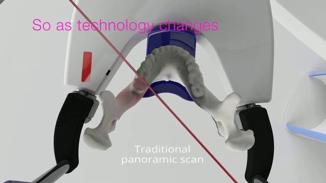 Planmeca ProMax SCARA Technology