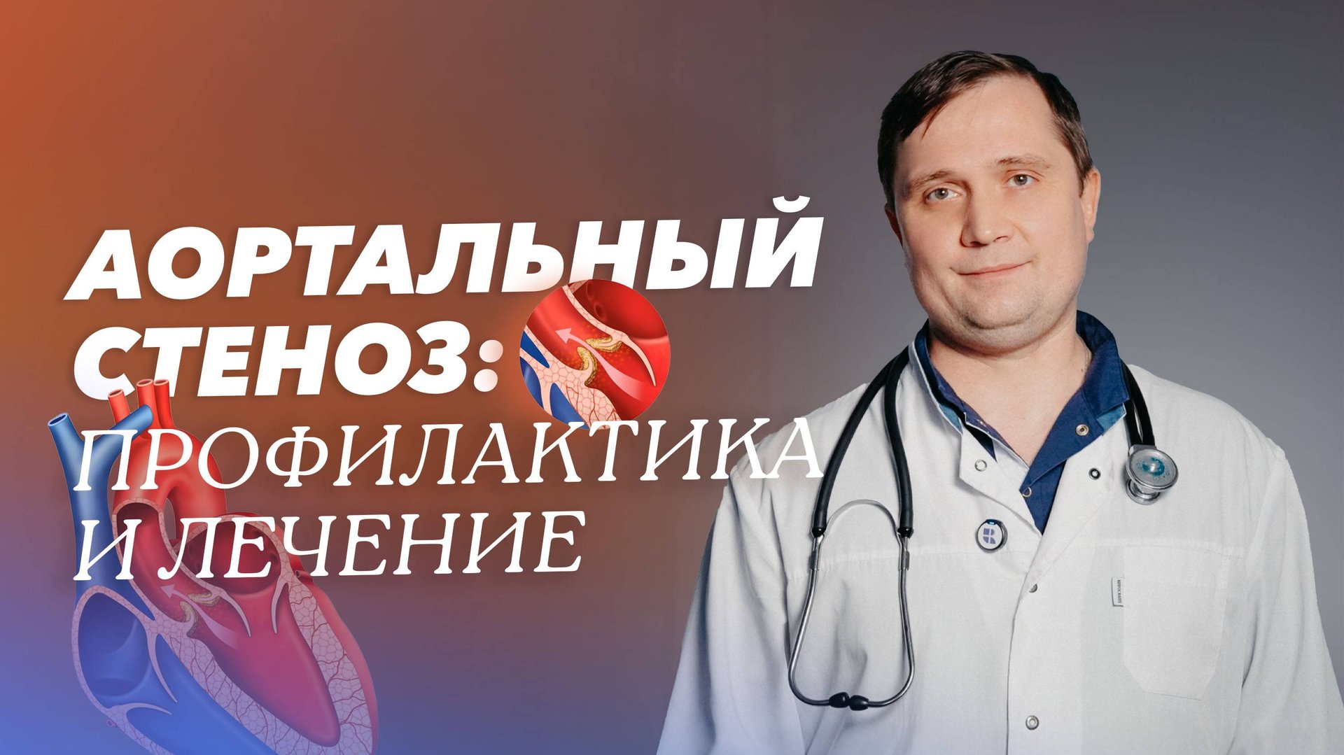 Аортальный стеноз: симптомы, лечение и профилактика смотреть онлайн