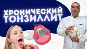 ХРОНИЧЕСКИЙ ТОНЗИЛЛИТ И БОЛЬ В ШЕЕ