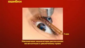 Измерение внутриглазного давления индикатором ИГД-02 (1)