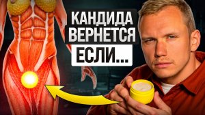 НЕ лечите КАНДИДУ так! 6 ошибок, из-за которых кандидоз возвращается