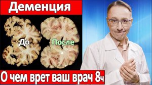 Избежать болезнь Альцгеймера и ВЫЛЕЧИТЬ деменцию. О чем врет ваш врач 8 часть