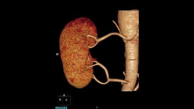 Philips Medical Systems  Brilliance ICT