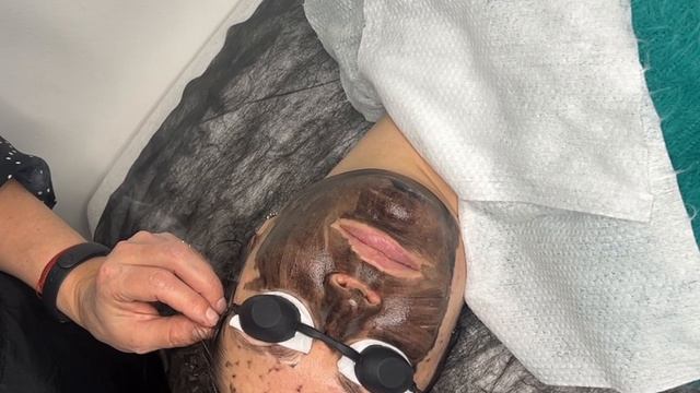 Что дает КАРБОНОВЫЙ ПИЛИНГ? смотреть онлайн