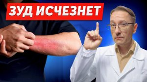 5 советов при ЭКЗЕМЕ: Как остановить зуд и вылечить кожу?