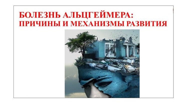 БОЛЕЗНЬ АЛЬЦГЕЙМЕРА: ПРИЧИНЫ И МЕХАНИЗМ РАЗВИТИЯ