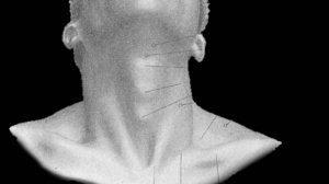 Клетчаточные пространства шеи: анатомия и клиника