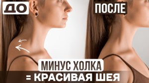 Убрать холку и сутулость за 10 минут | Упражнения для красивой шеи и ровной спины