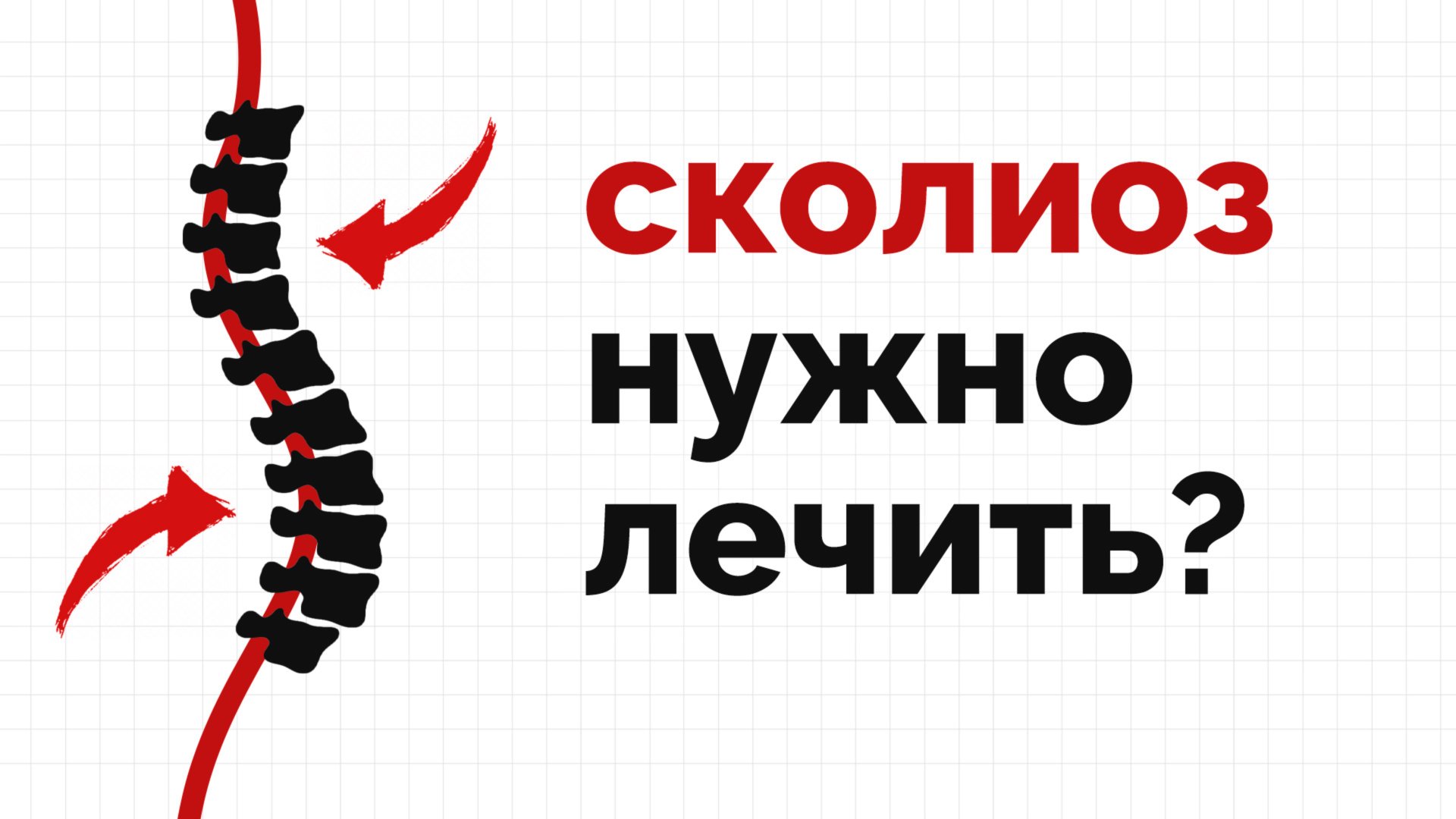 Сколиоз: простыми словами о сложном диагнозе смотреть онлайн