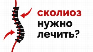 Сколиоз: простыми словами о сложном диагнозе