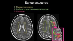 Базовый курс по МРТ- 1. Лекция -МР-анатомия головного мозга-. Лектор- Кротенкова И.А.