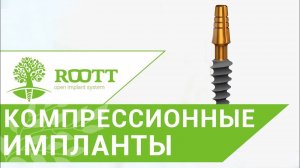 Преимущества компрессионных имплантов. Компрессионные импланты ROOTT