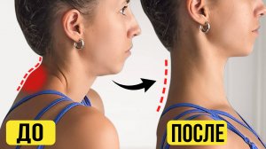 Как убрать холку на шее за 10 МИНУТ в день? Быстрое исправление горбинки на шее