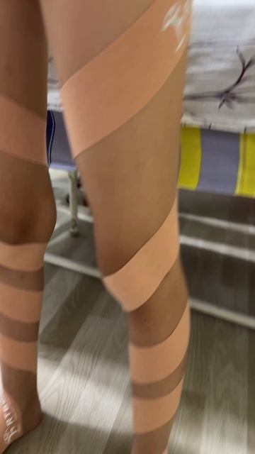 тейпированте при внутреннем завале стопы (вальгусные стопы) #RTBalance #АВАР #тейп #ВячеславРеут смотреть онлайн