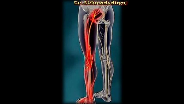 Упражнения при боли в спине и ноге. Седалищный нерв, упражнения. Ахмадудинов А.М.