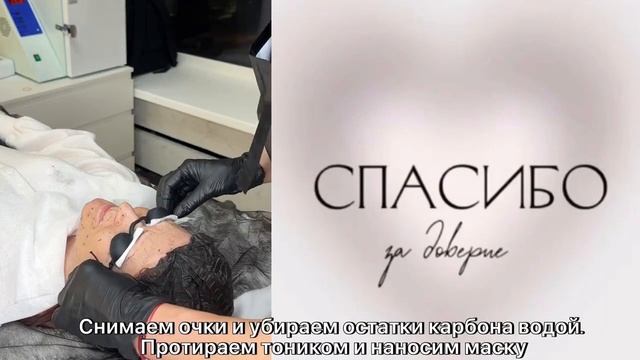 Карбоновый пилинг смотреть онлайн