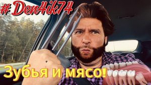 Продолжение Эпопеи с Зубами.. Нет Лечения! Еду к Ралине.