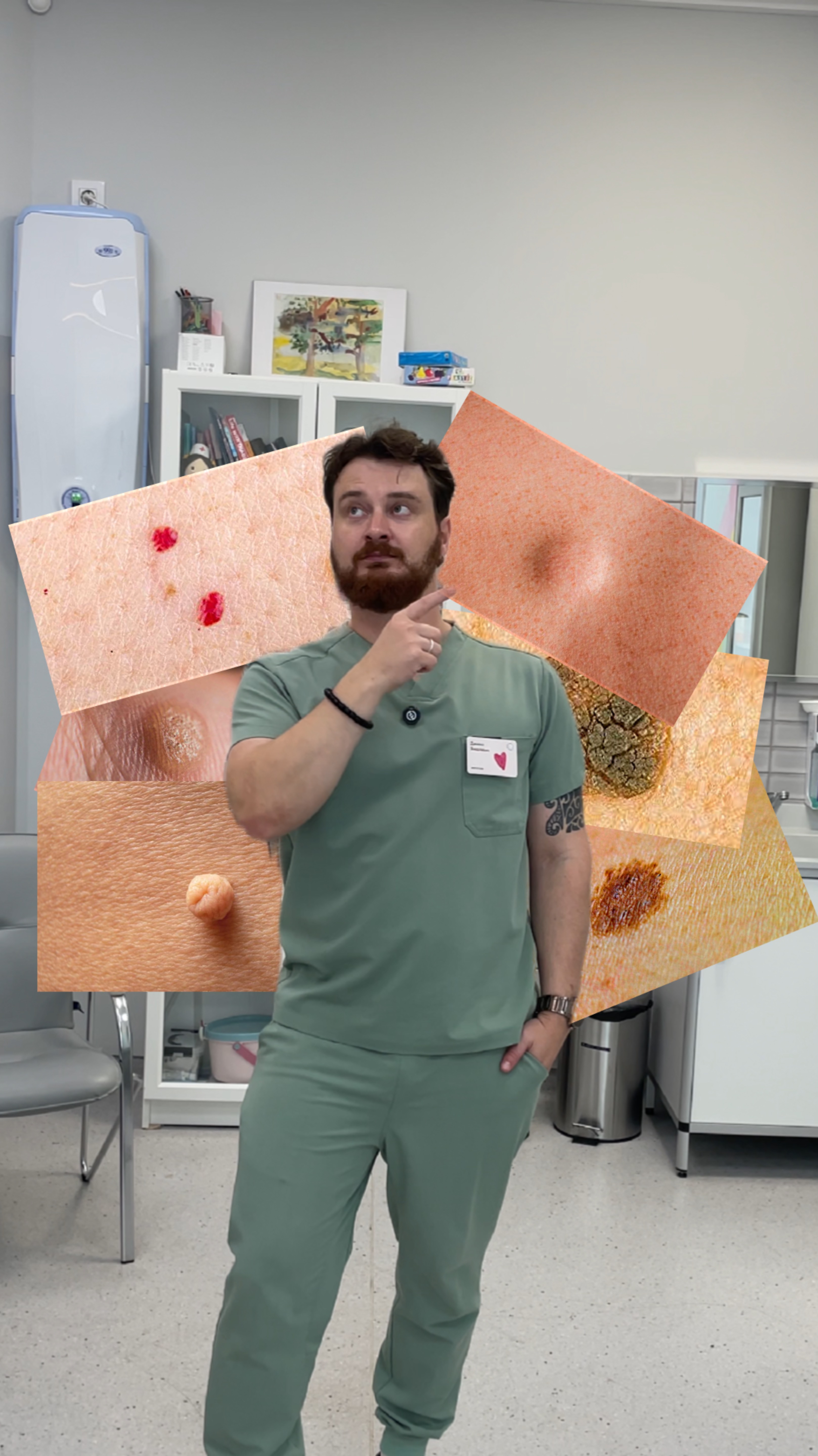 Образования на коже