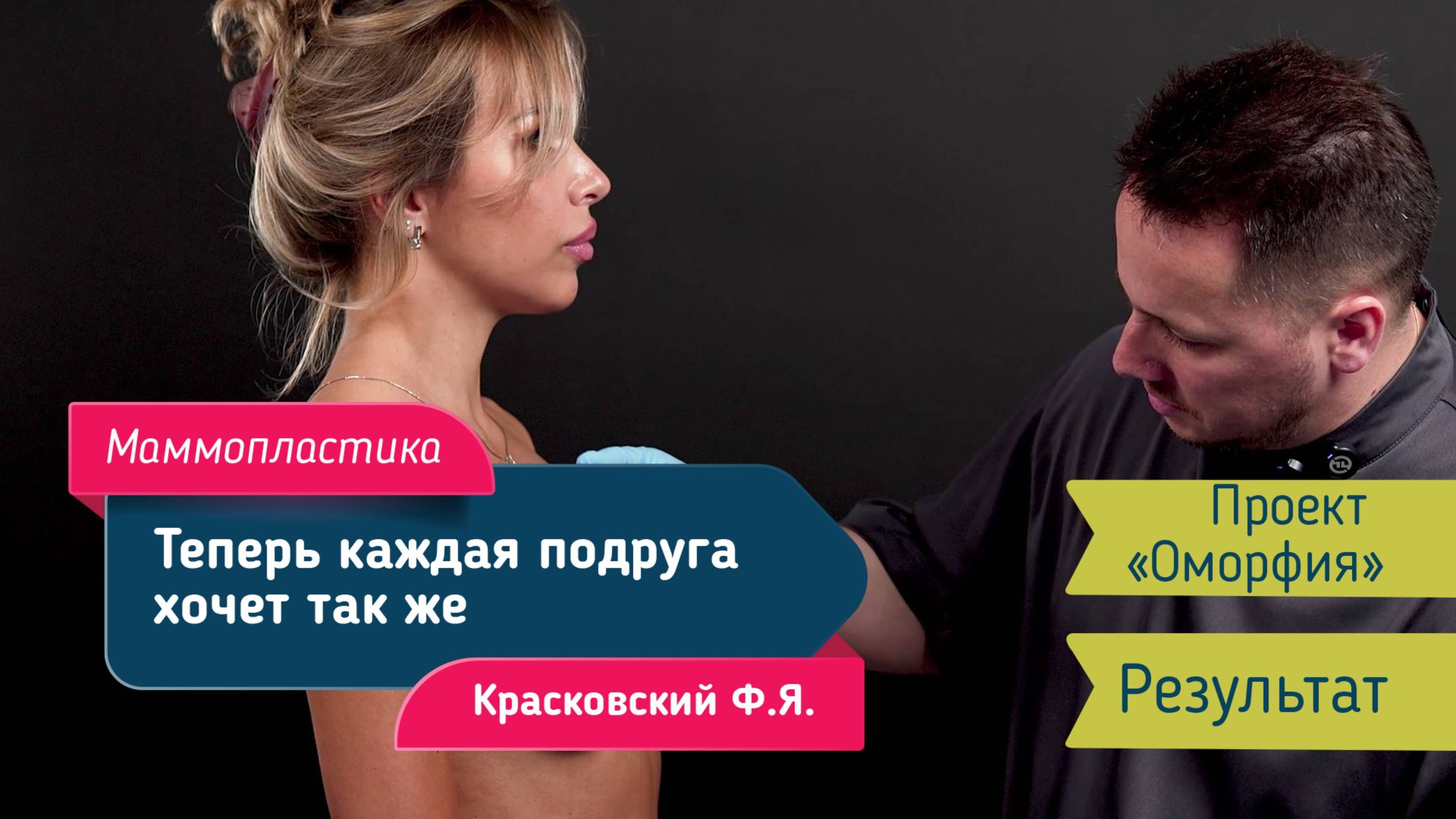 Маммопластика по проекту «Оморфия» | Алсу у хирурга Красковского Федора — результат через 3 месяца